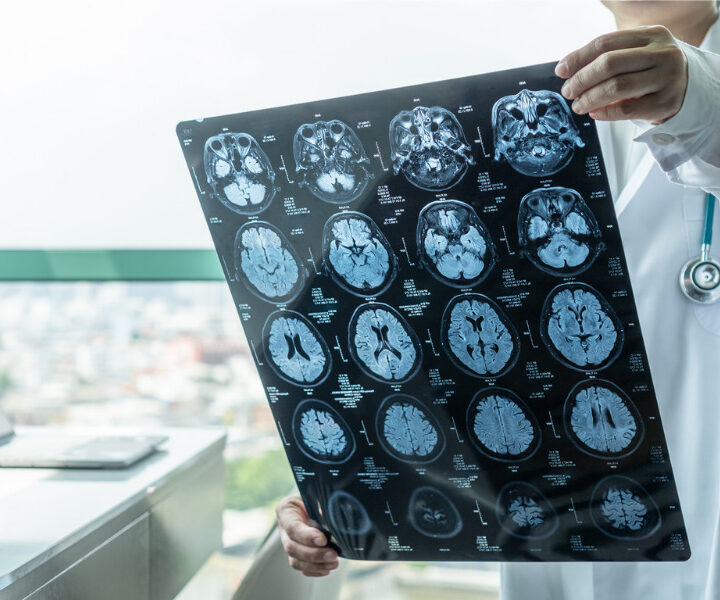 Brain Injury Claims in Houston: How Brain Injuries Occur and Who Should be Held Liable for Them
